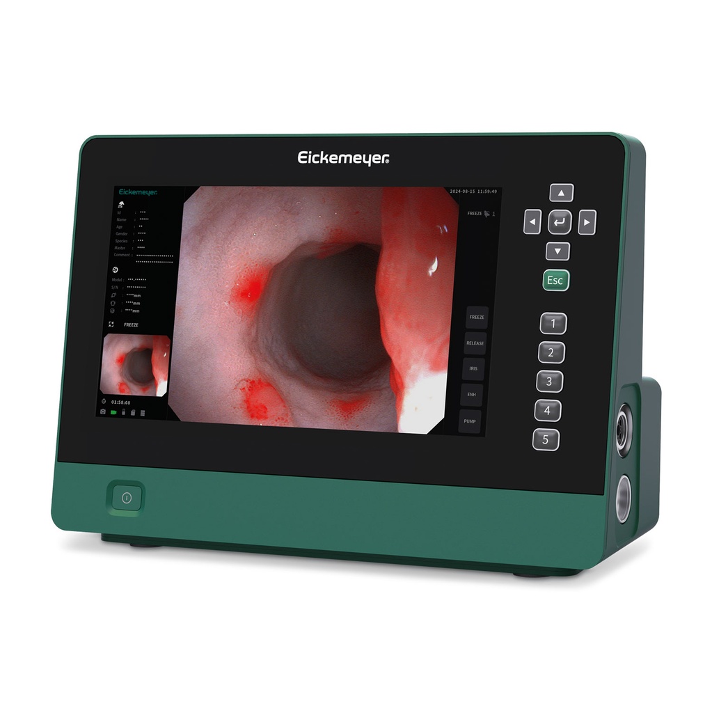 [DK]Endoskopsystem, EickView 5 i 1